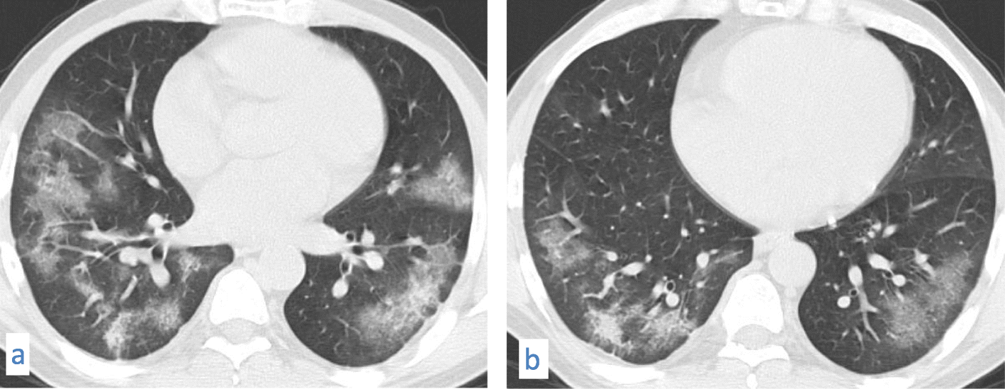 Fig. 11