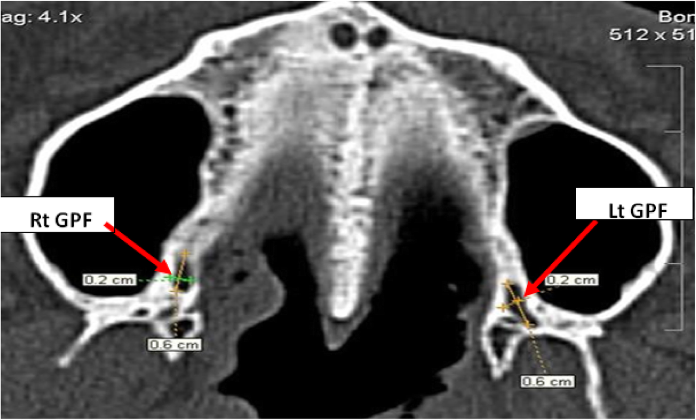 Fig. 6