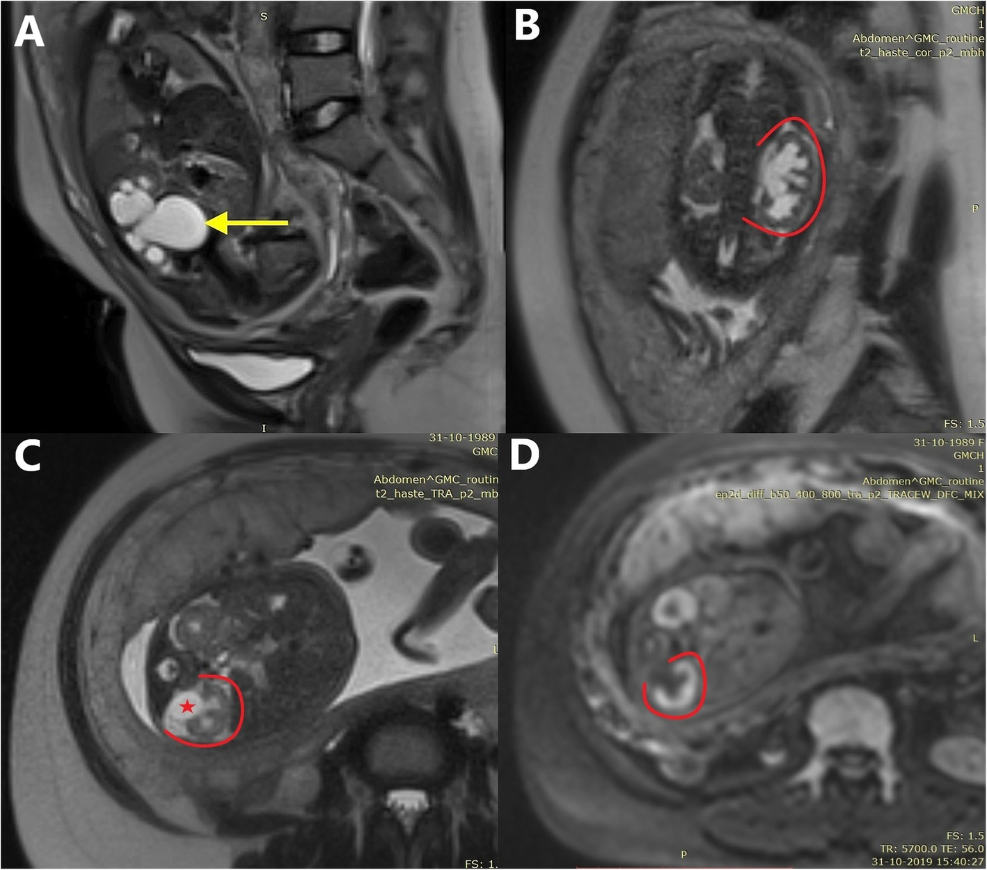 Fig. 4