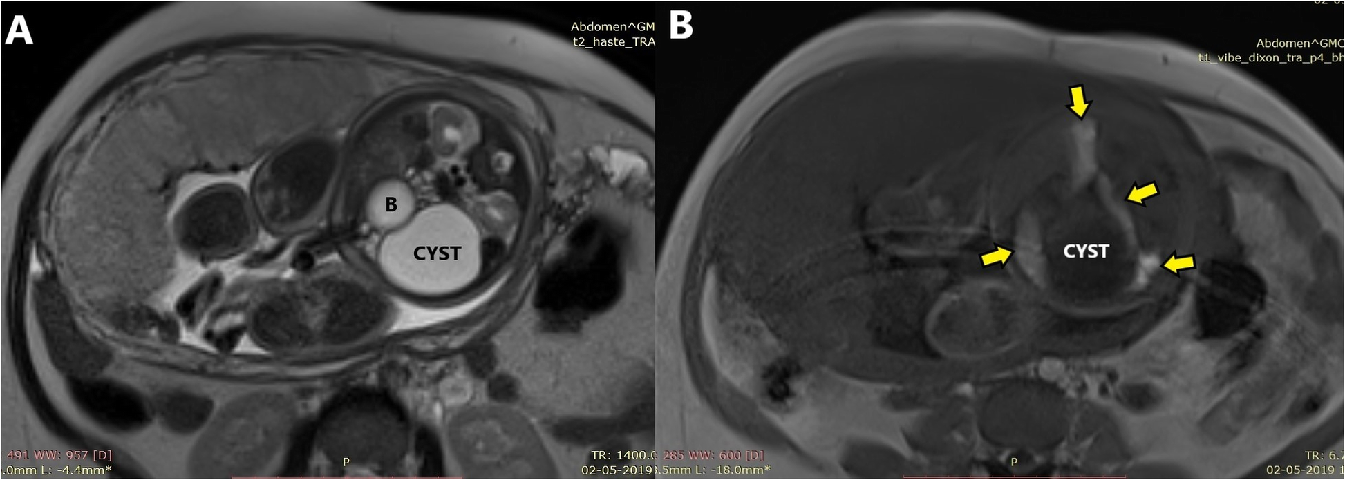 Fig. 8