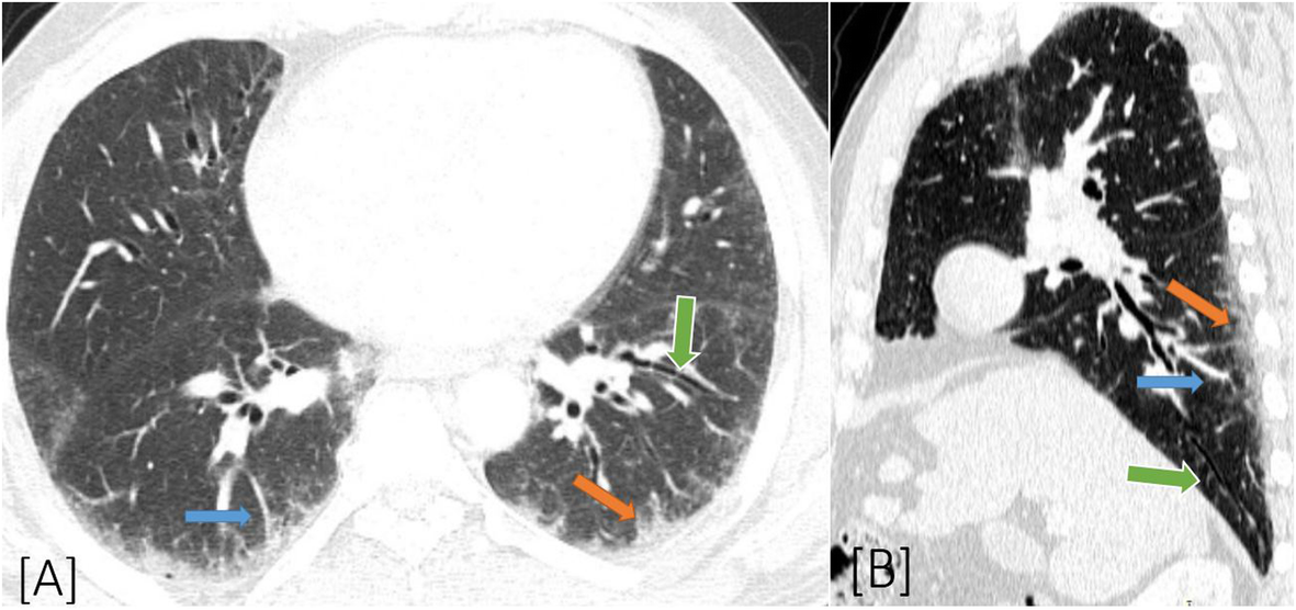 Fig. 9