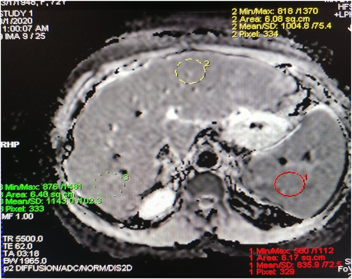 Fig. 2