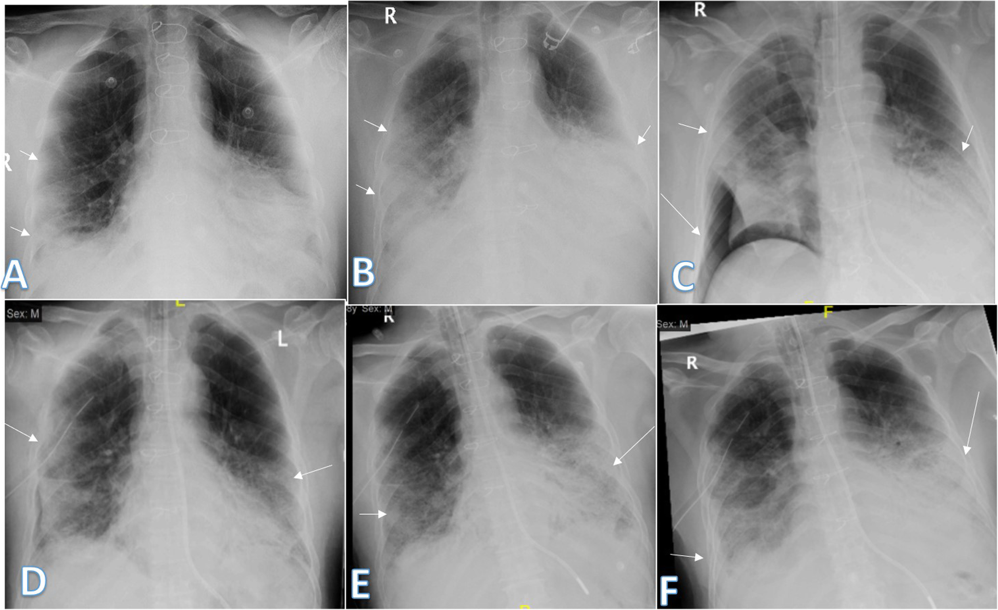 Fig. 17