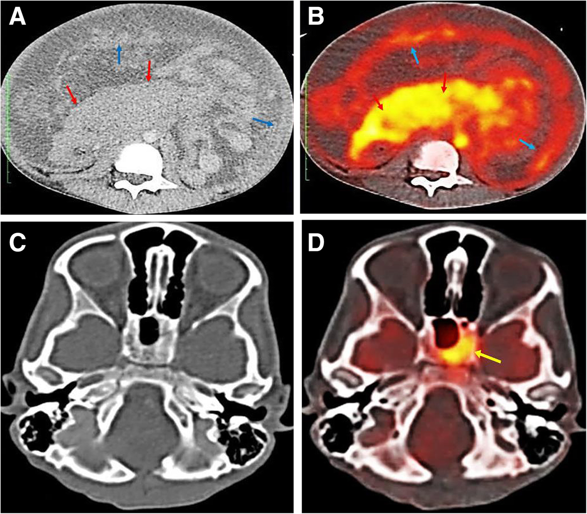 Fig. 12