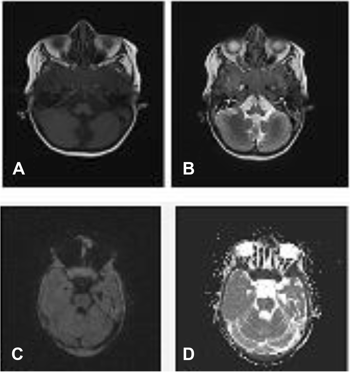 Fig. 11