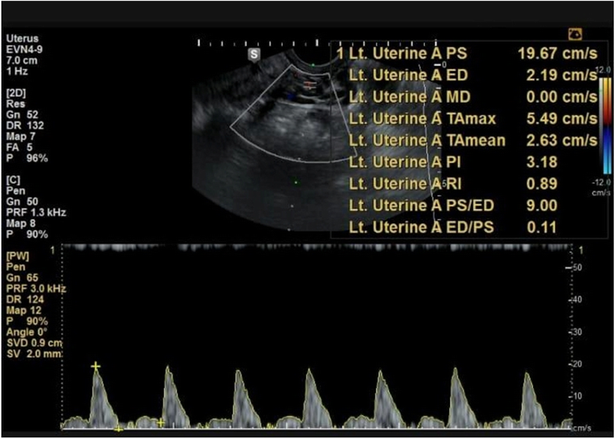 Fig. 1