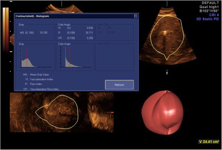 Fig. 6