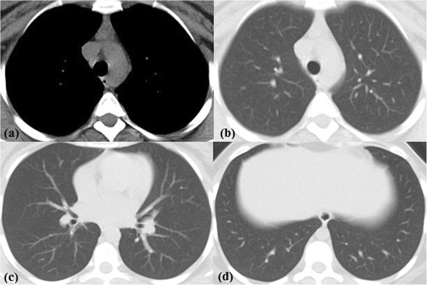 Fig. 4