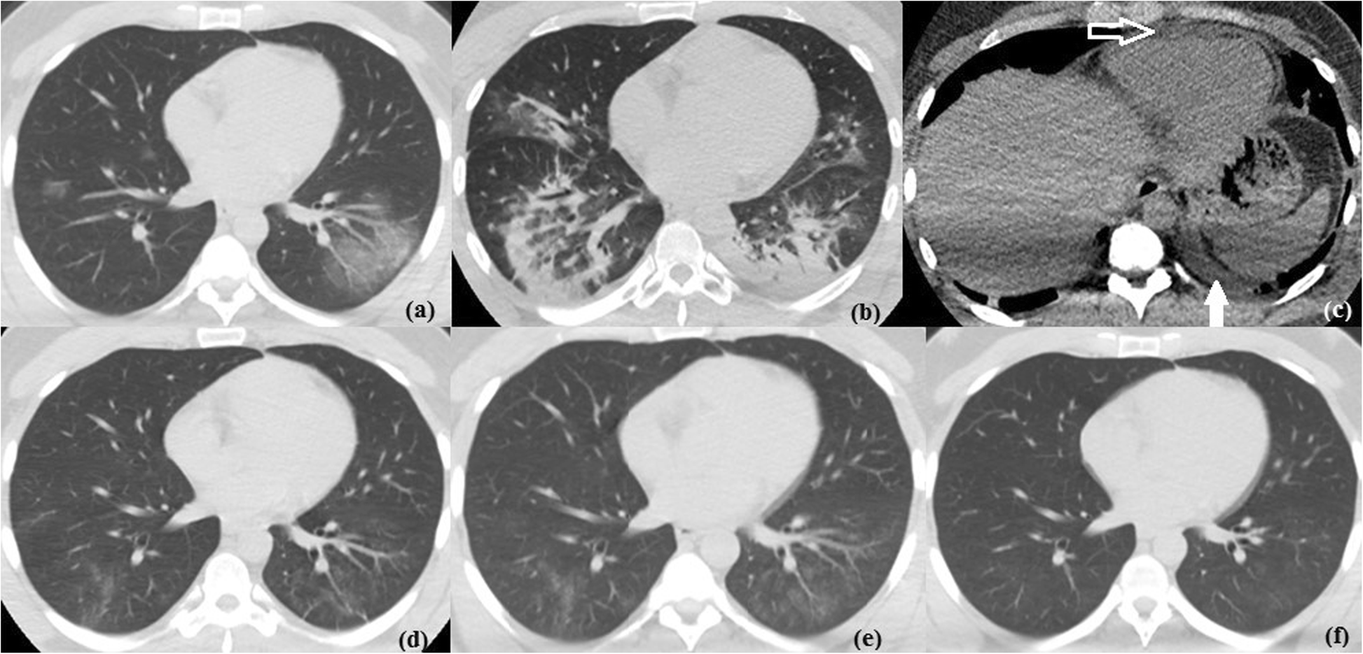 Fig. 5