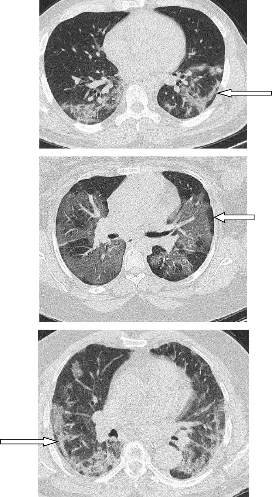 Fig. 18