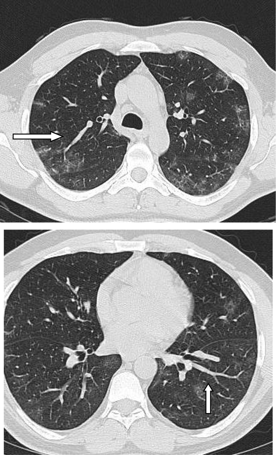 Fig. 20