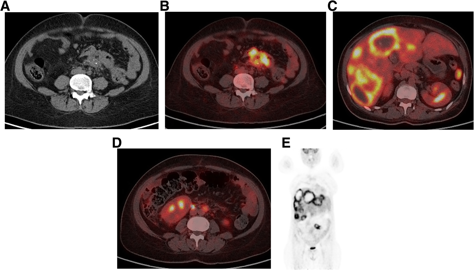 Fig. 2