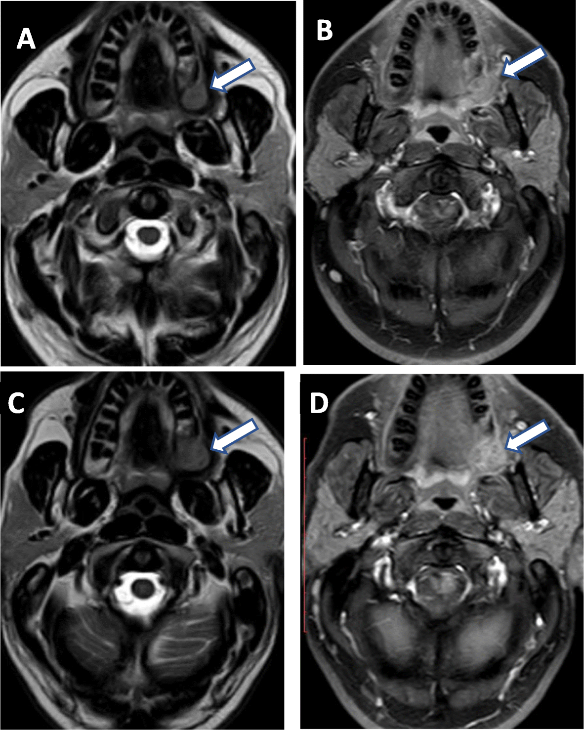 Fig. 5