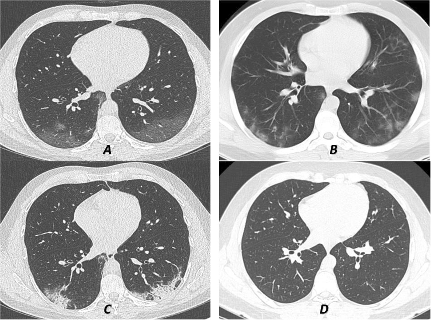 Fig. 4