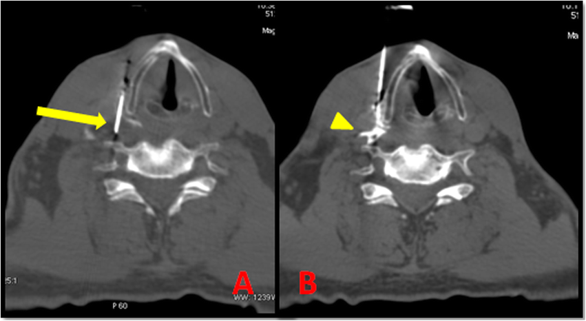 Fig. 10