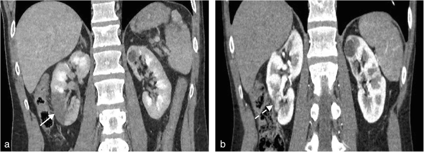 Fig. 17