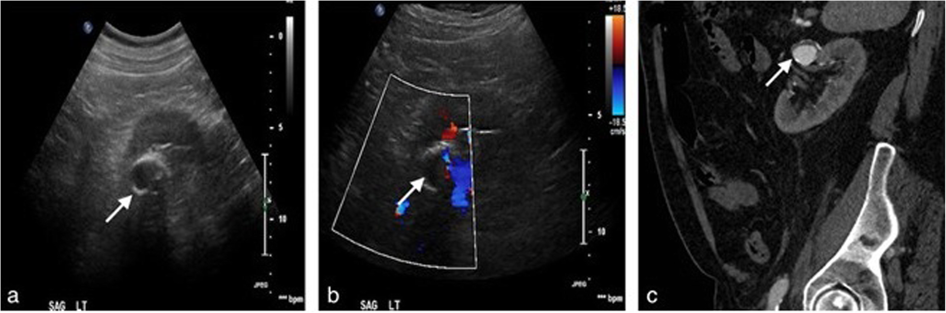 Fig. 18