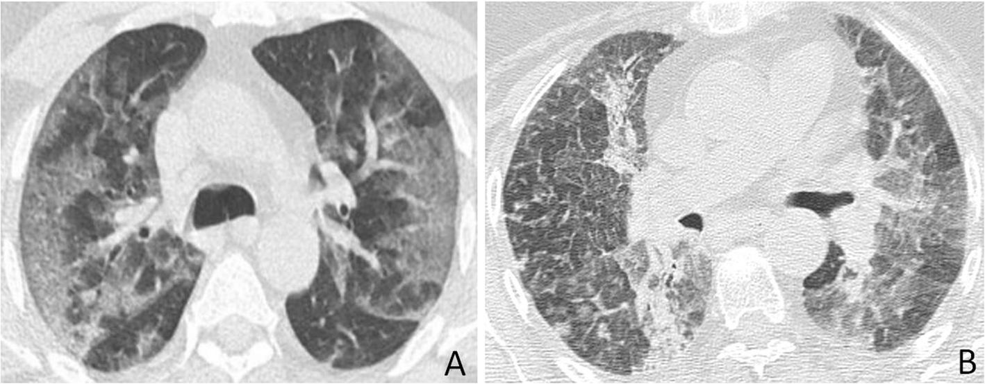 Fig. 5