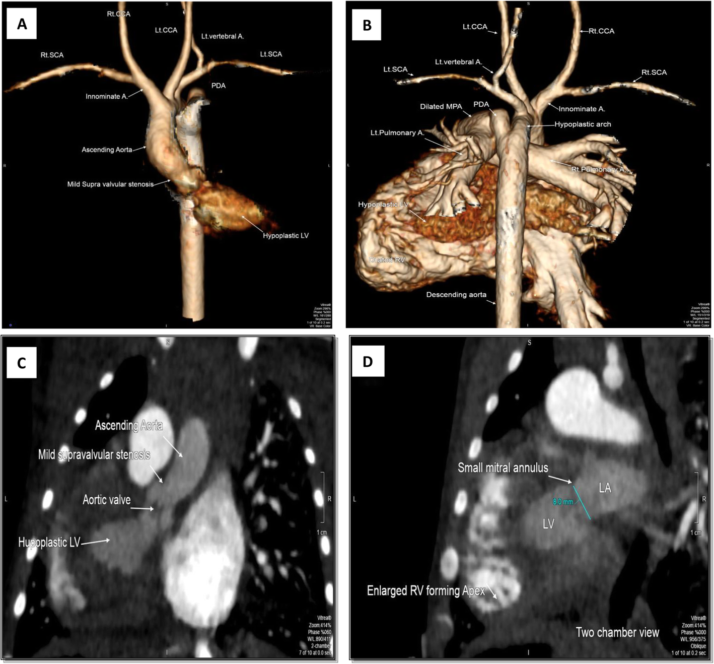 Fig. 4