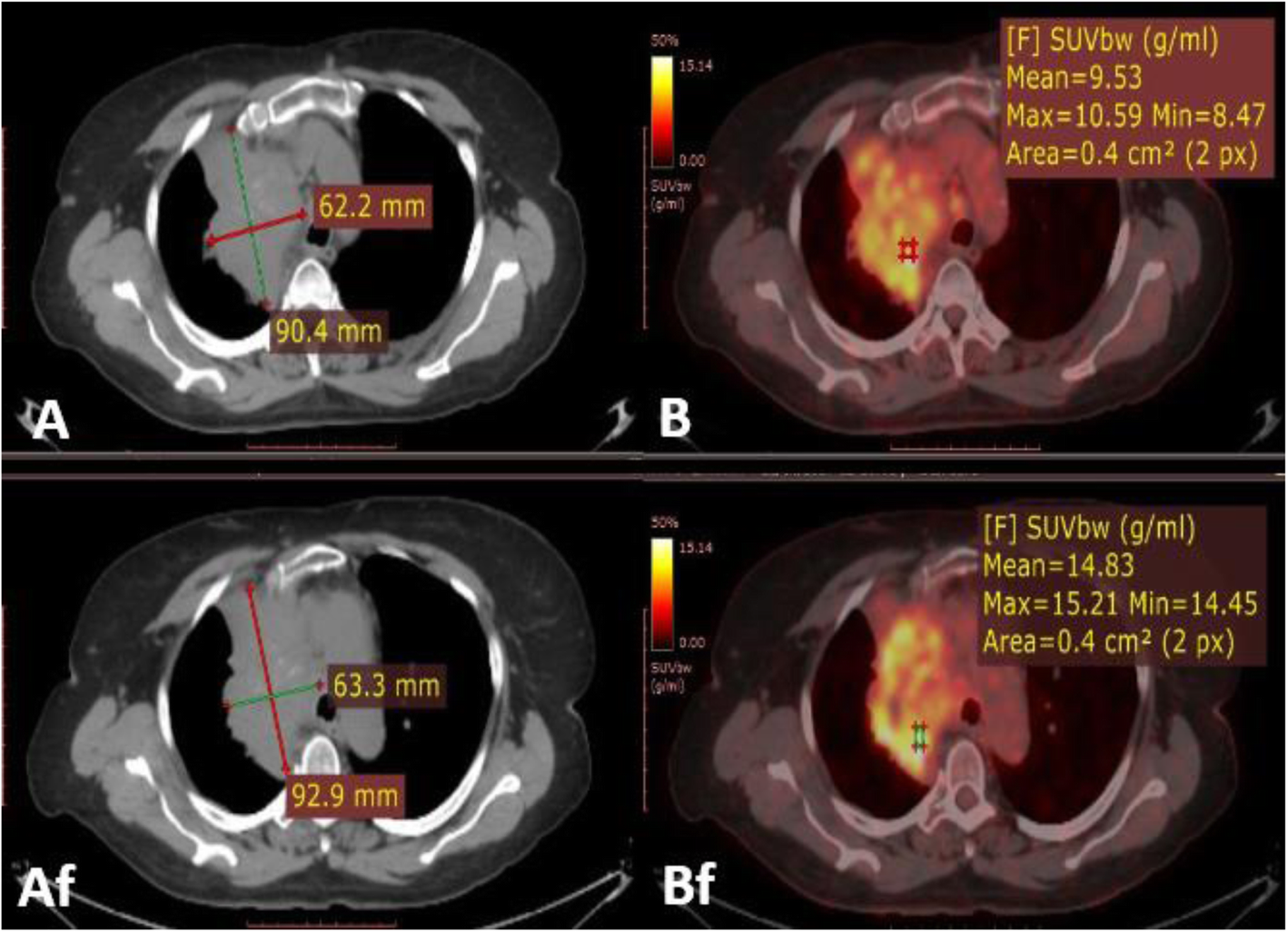 Fig. 13