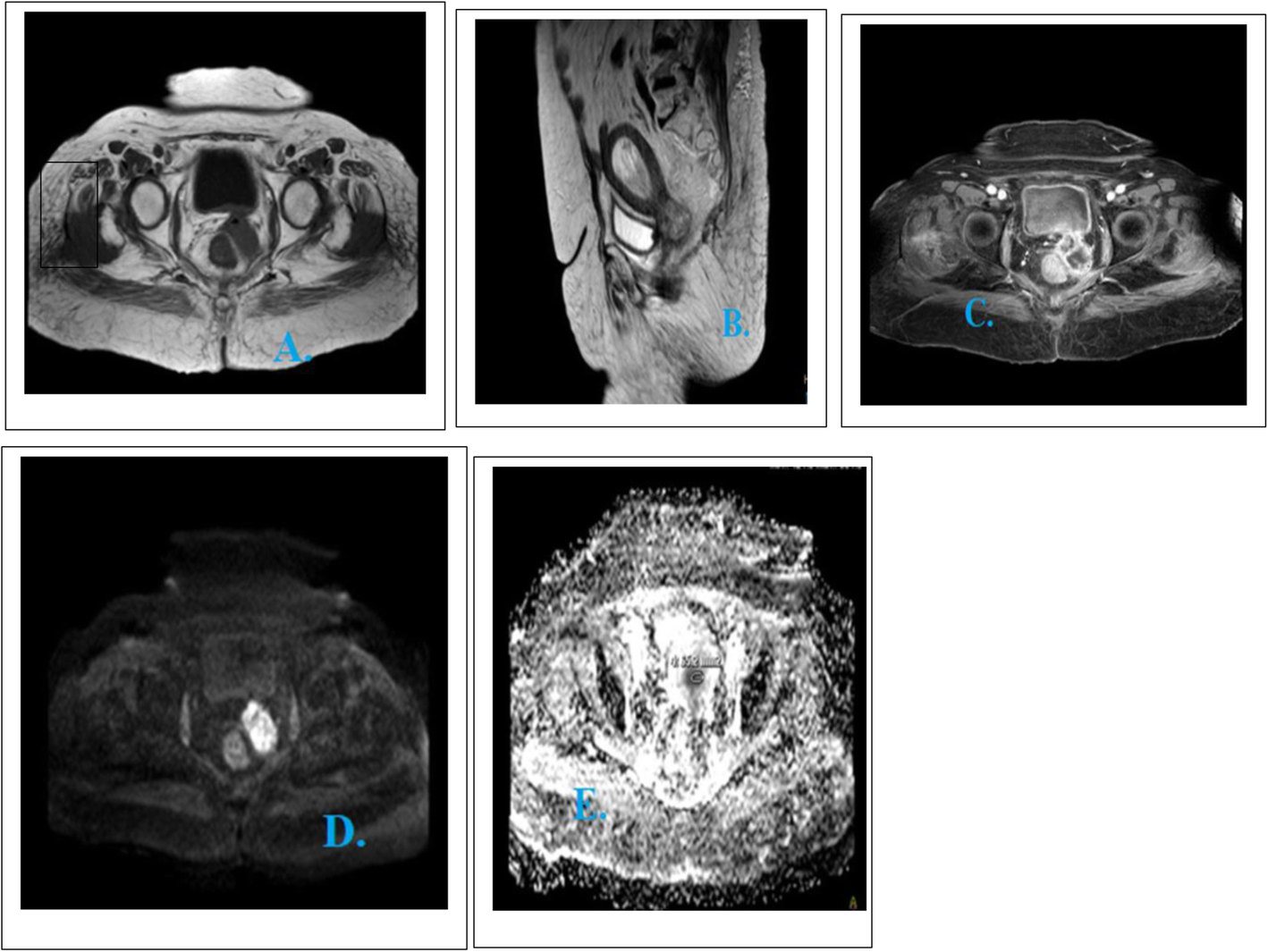 Fig. 5