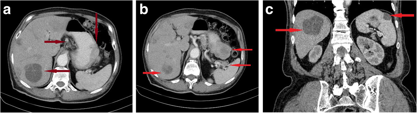 Fig. 2