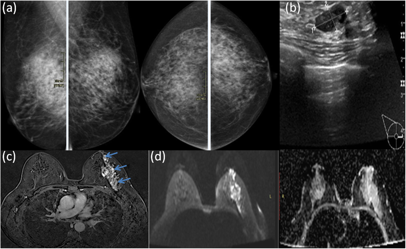 Fig. 4