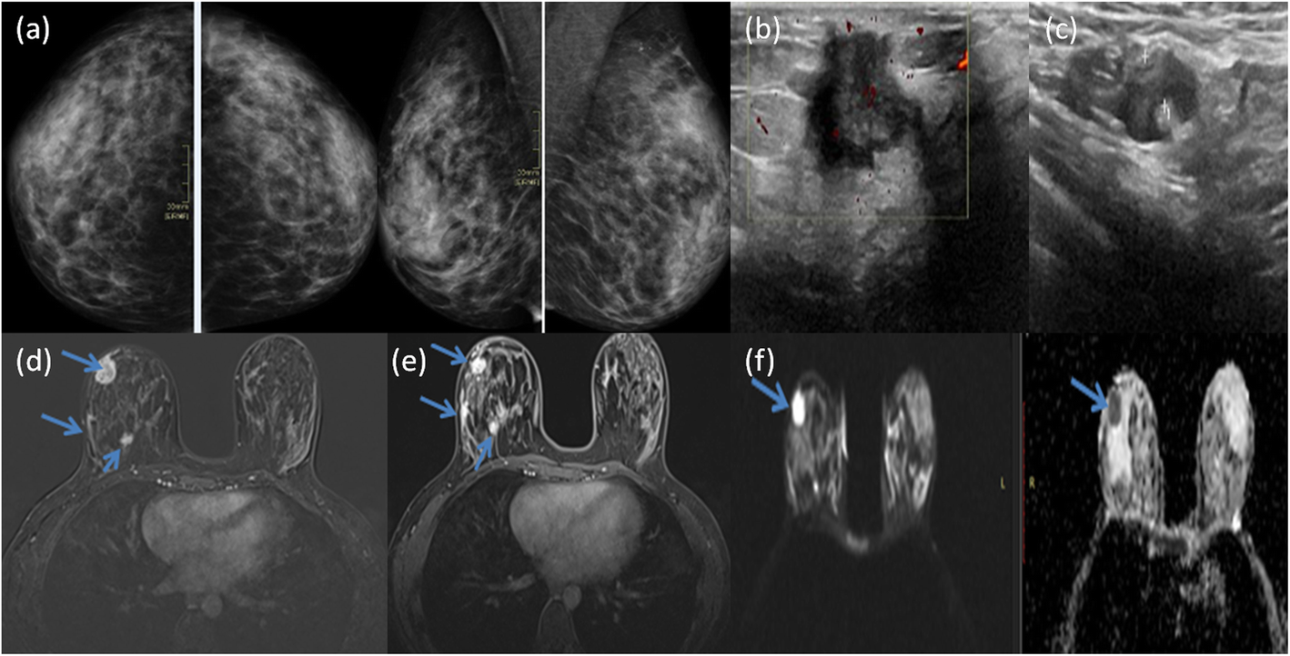 Fig. 5