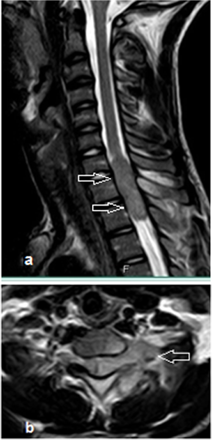 Fig. 11