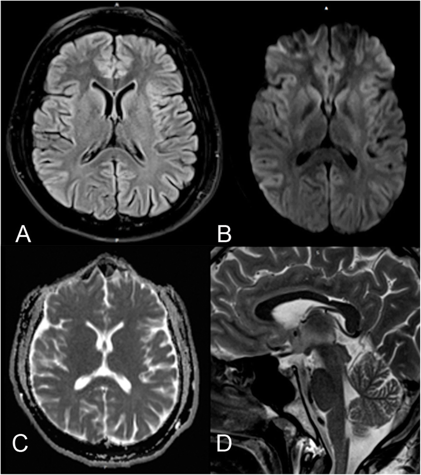 Fig. 4