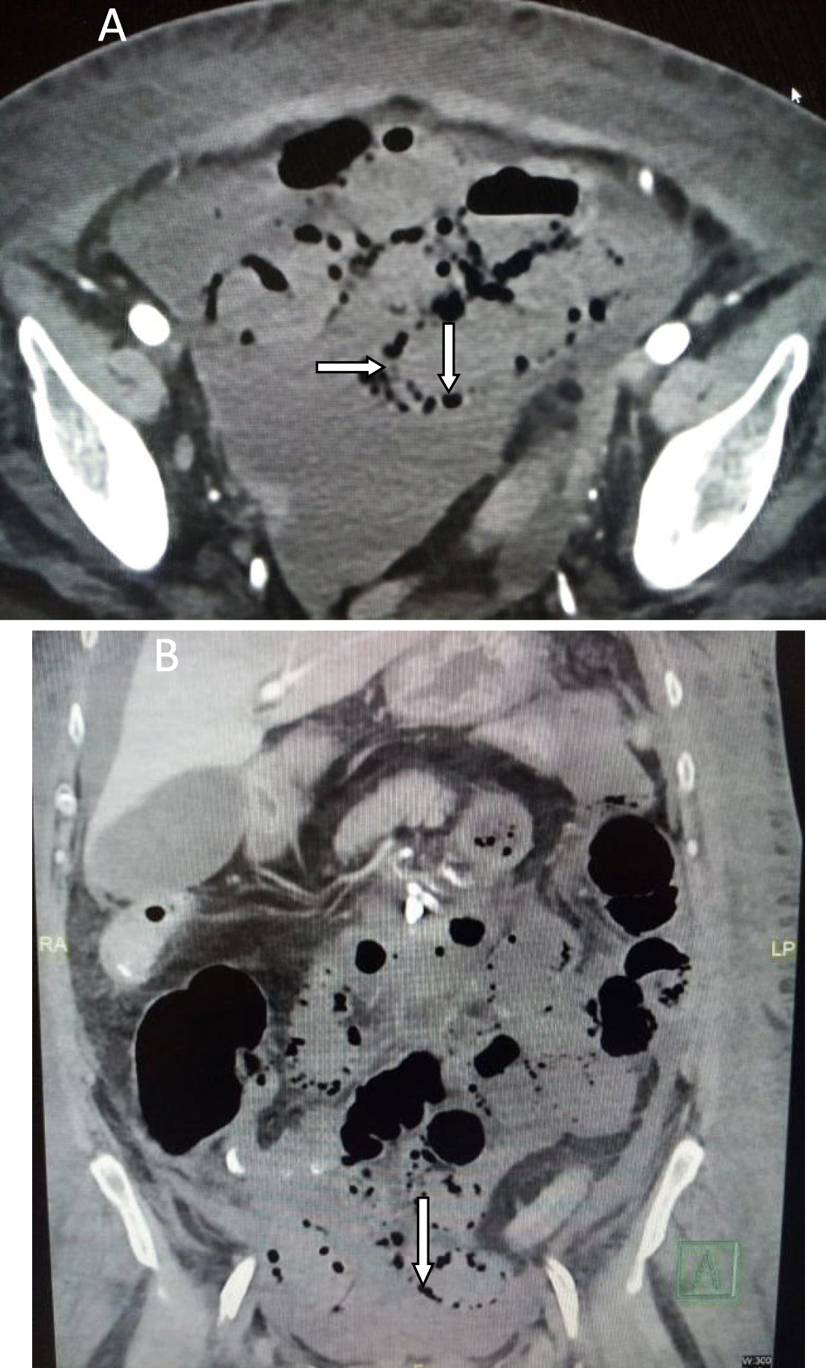 Fig. 2