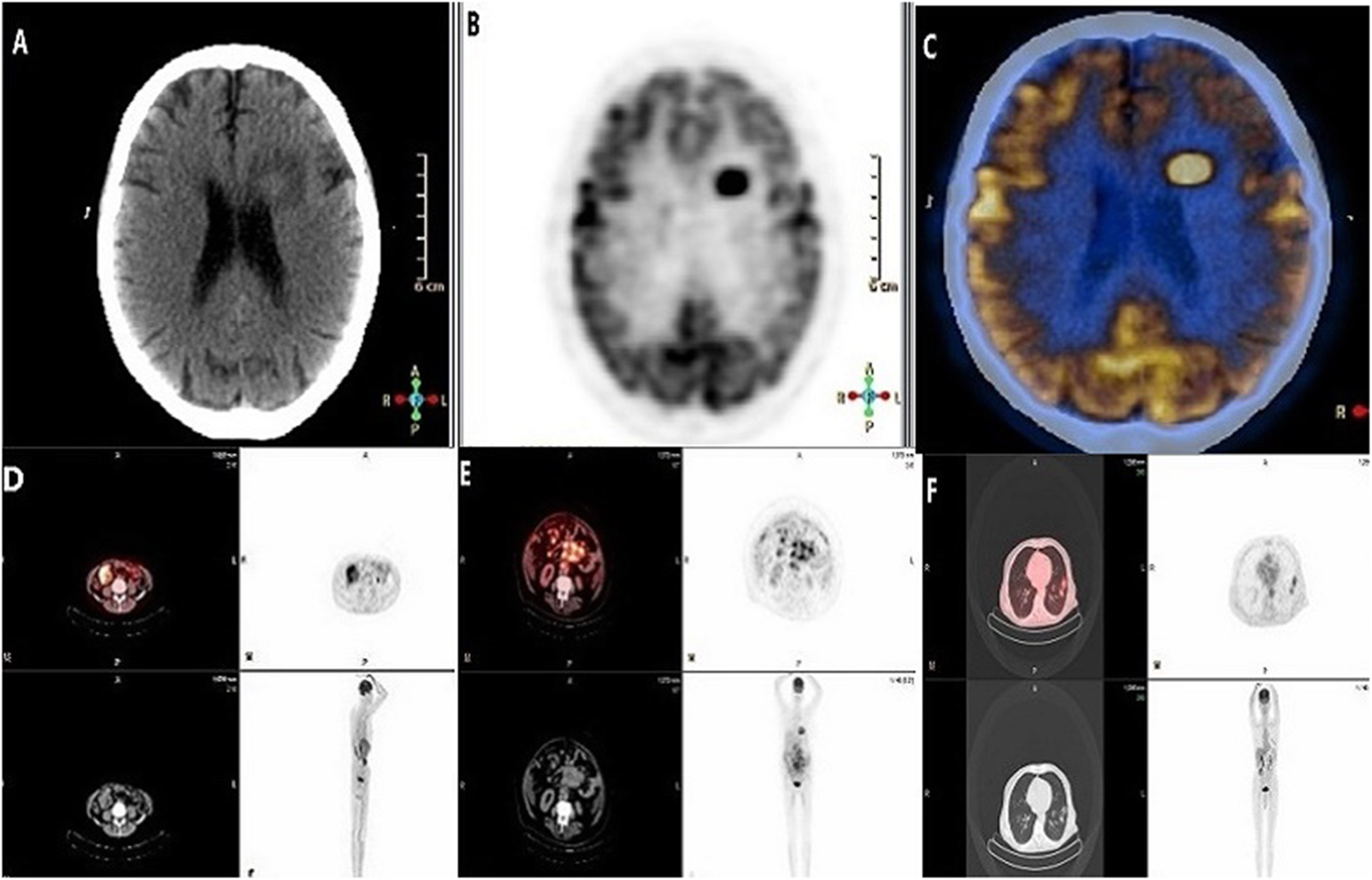 Fig. 6