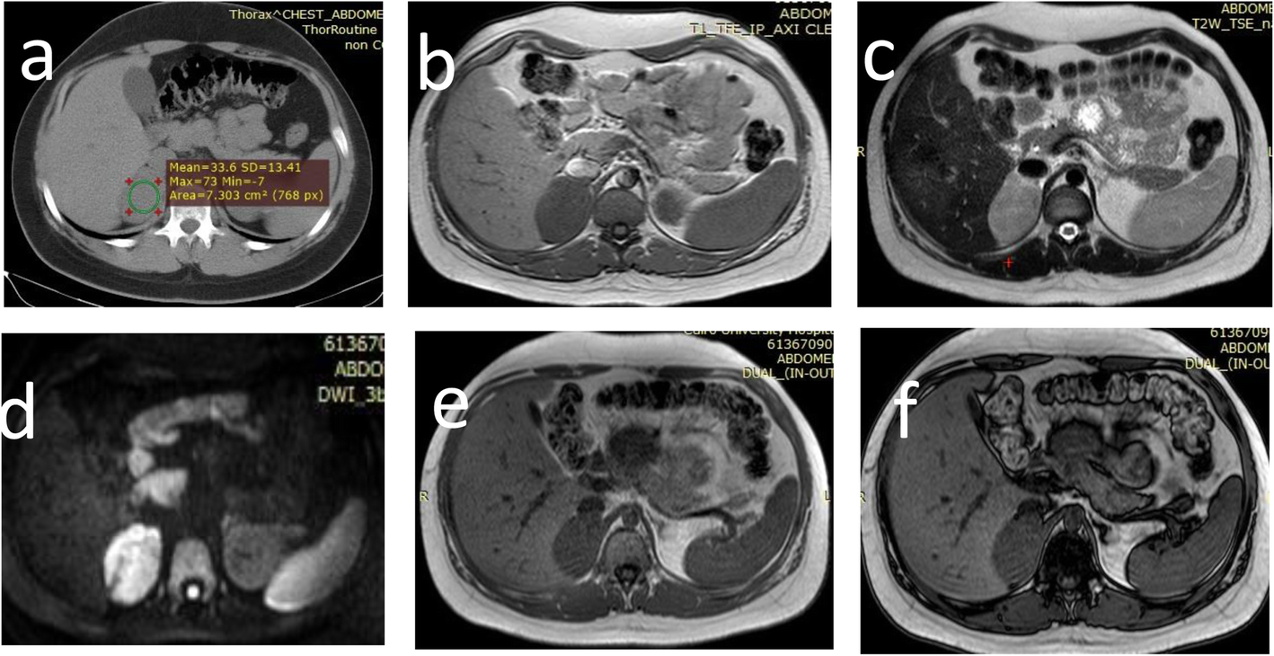 Fig. 5