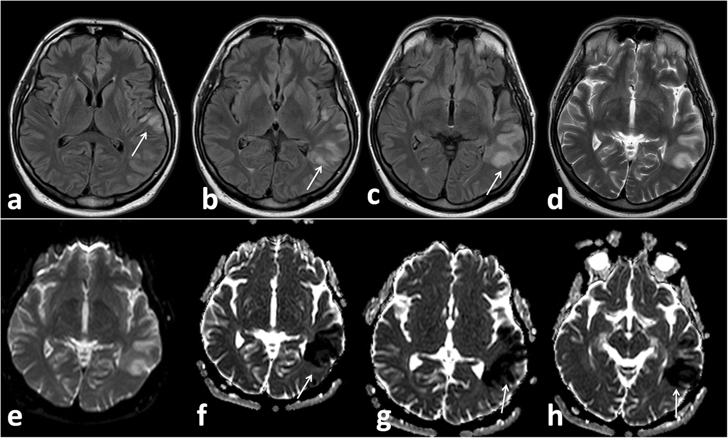 Fig. 11