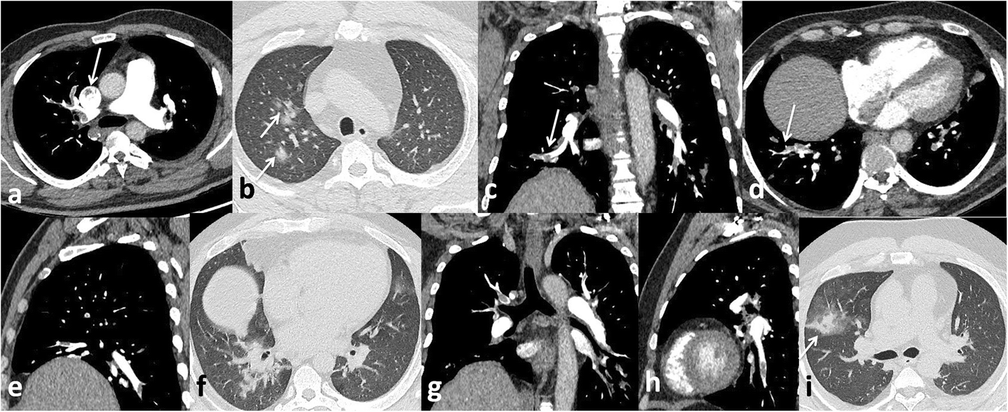 Fig. 5