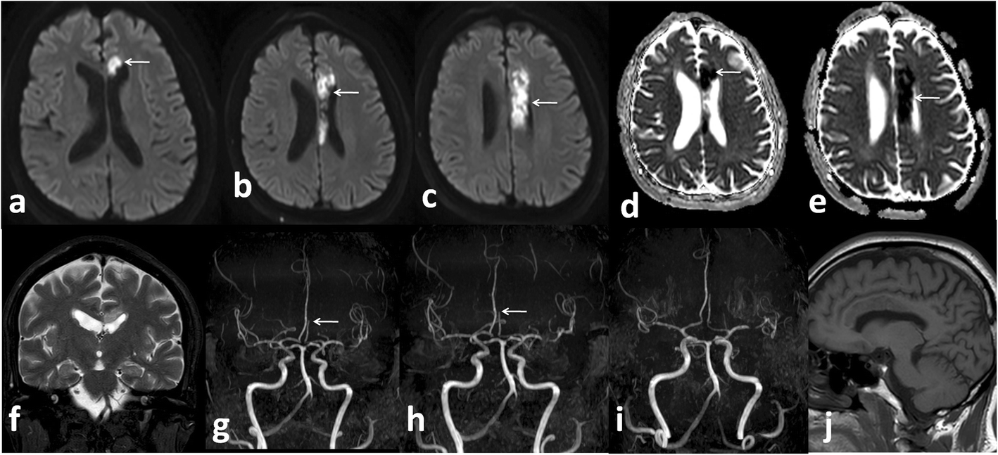 Fig. 8