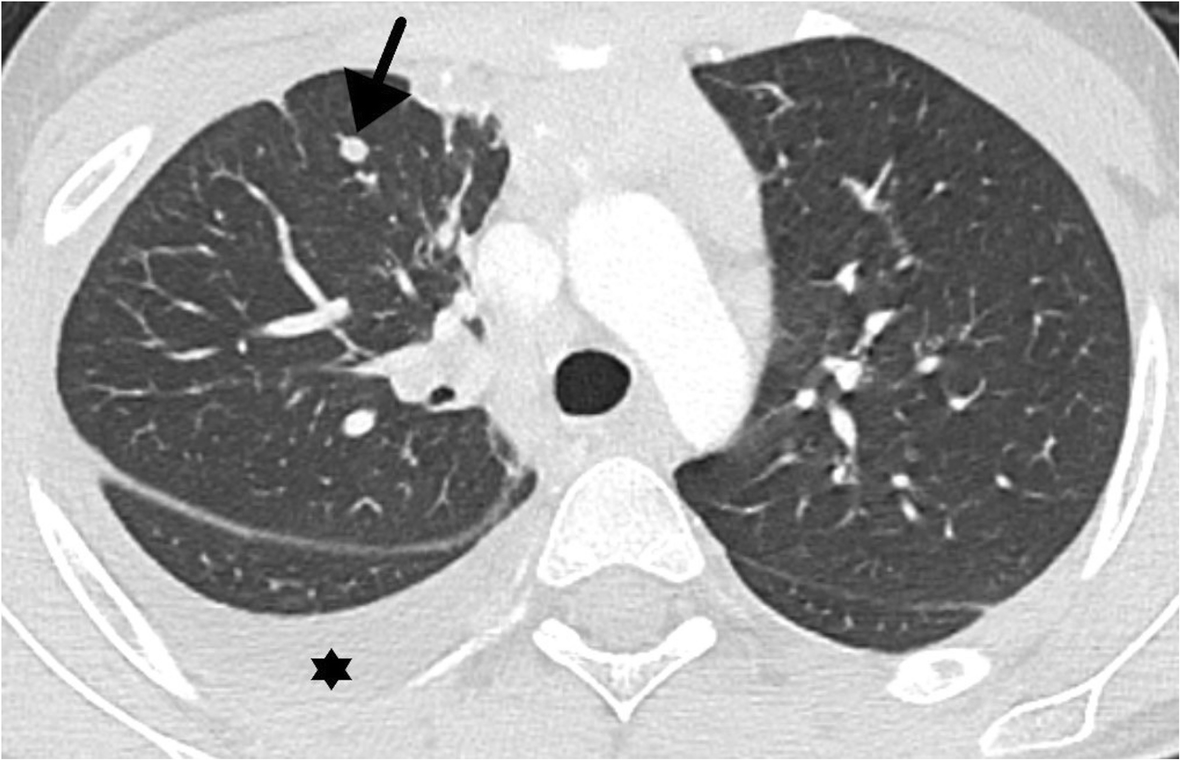 Fig. 10