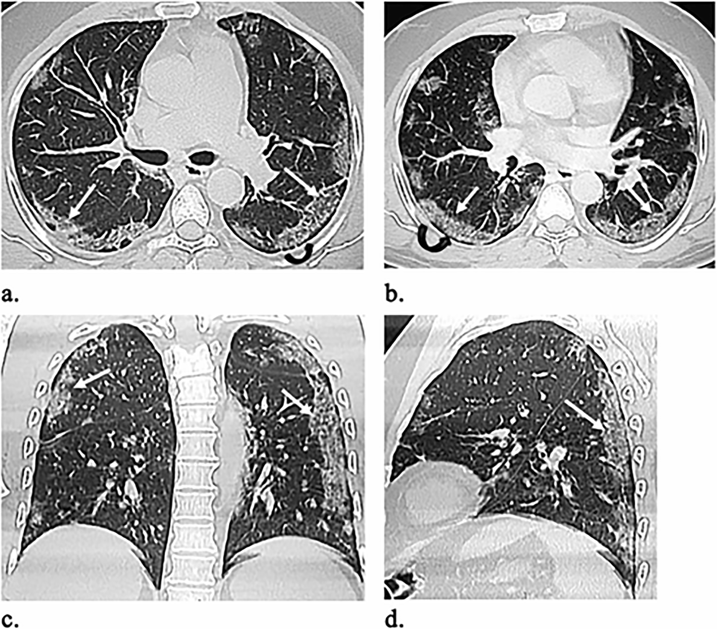 Fig. 4