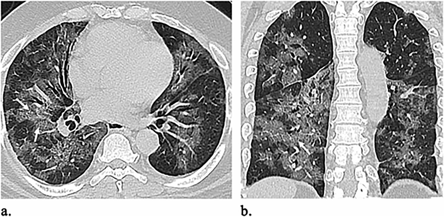 Fig. 5