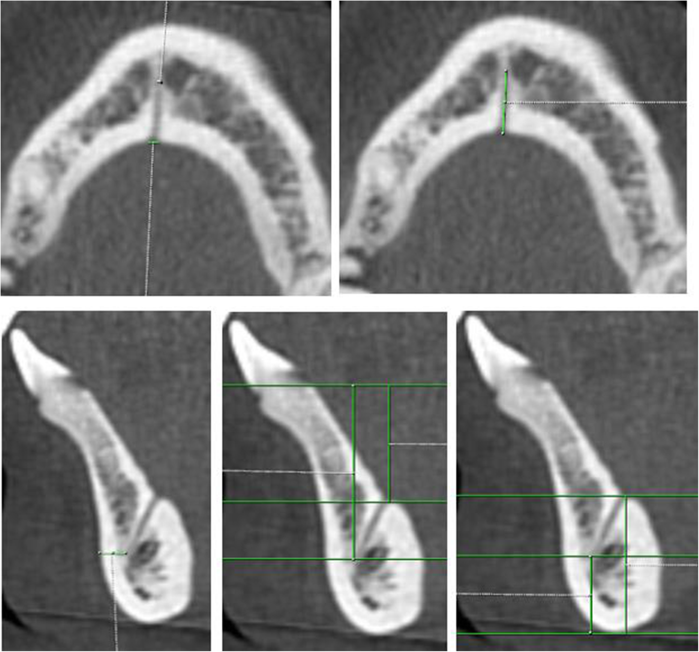 Fig. 4