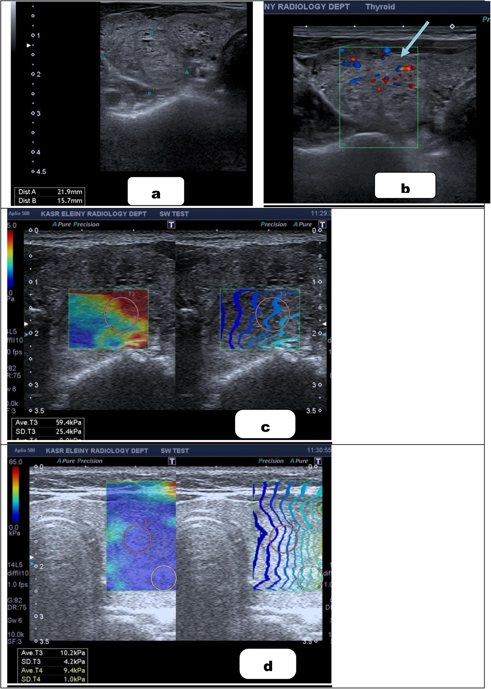 Fig. 6