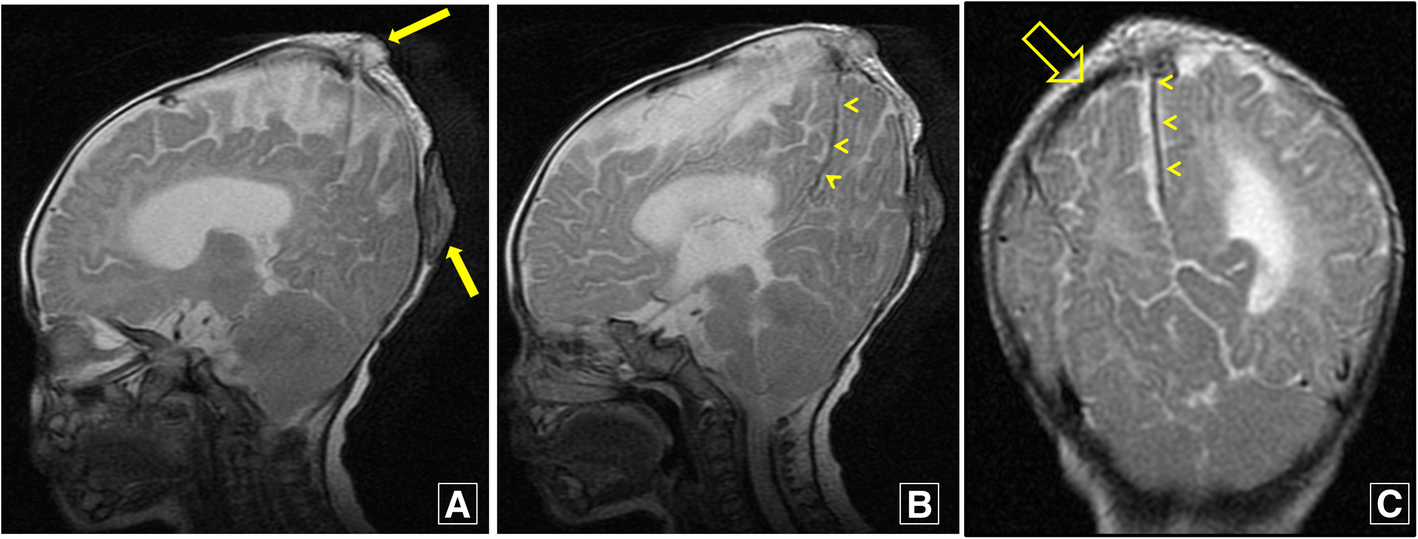 Fig. 9