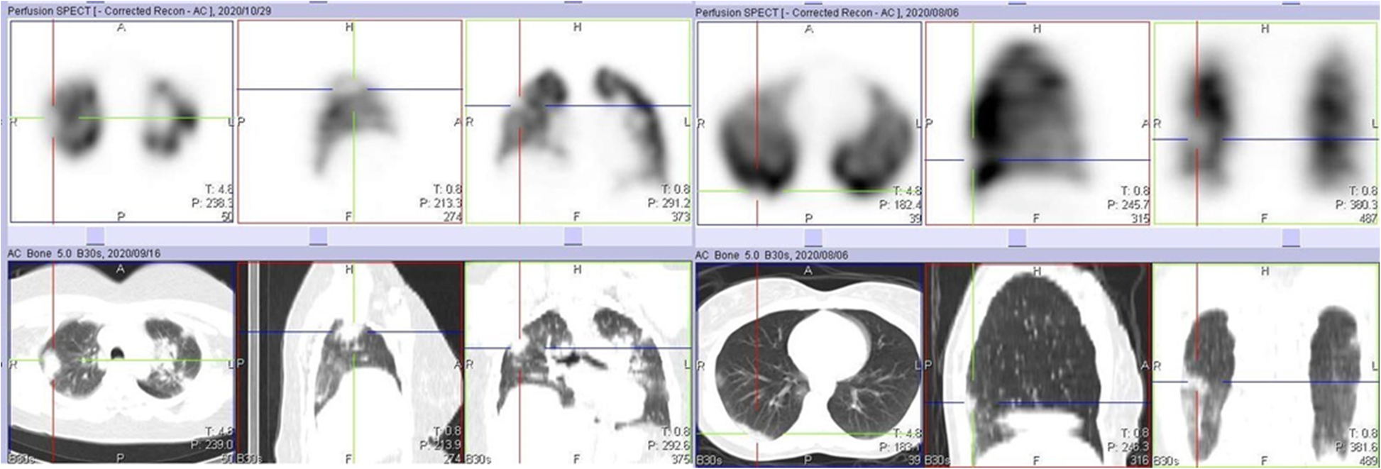 Fig. 11