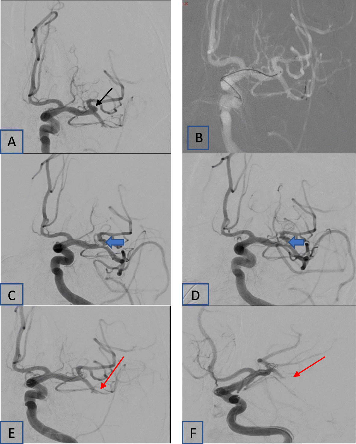 Fig. 6