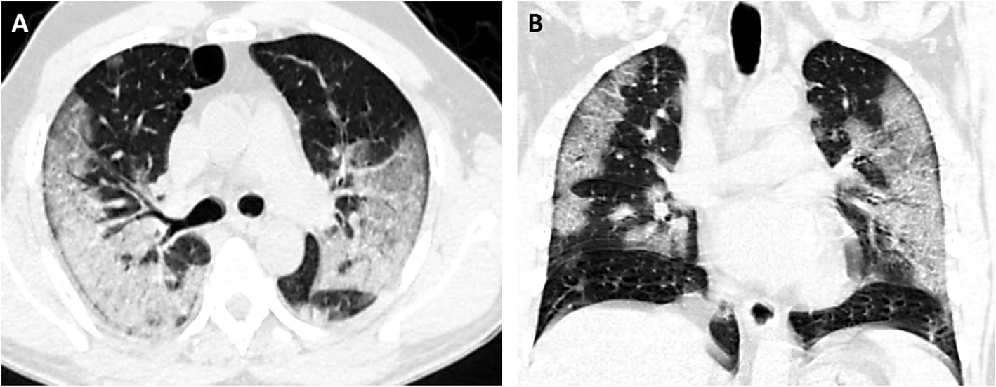 Fig. 4