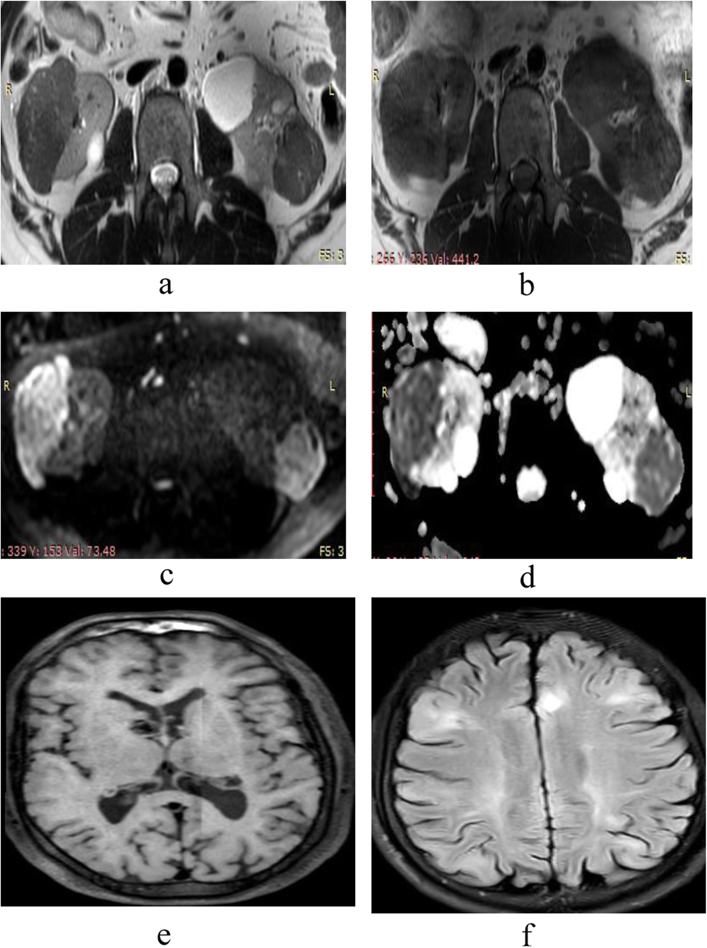 Fig. 11