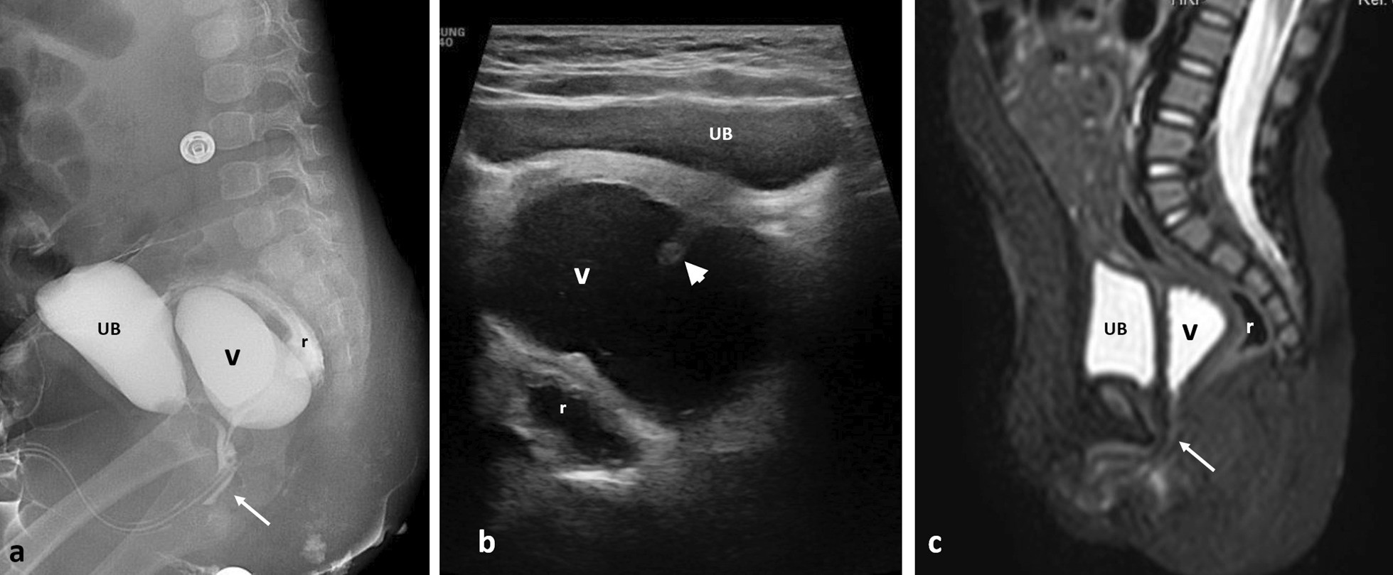 Fig. 18