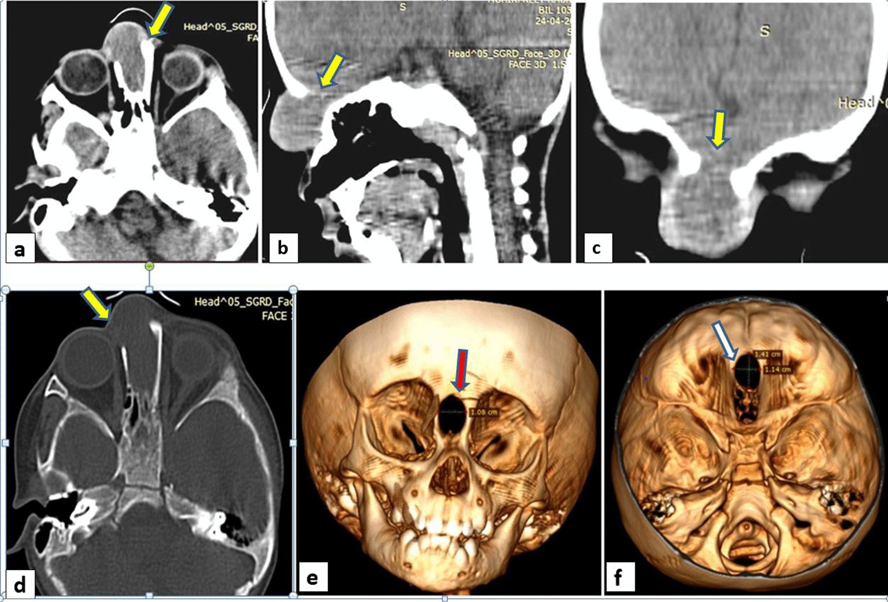 Fig. 2