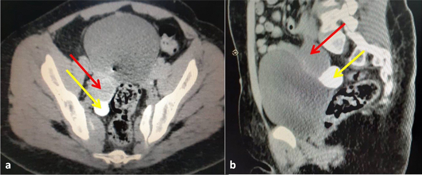 Fig. 3