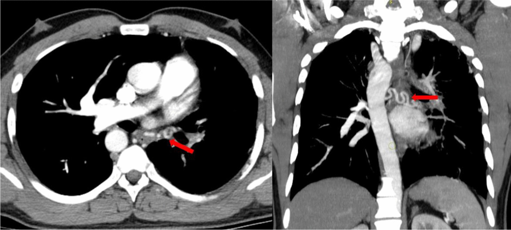 Fig. 5